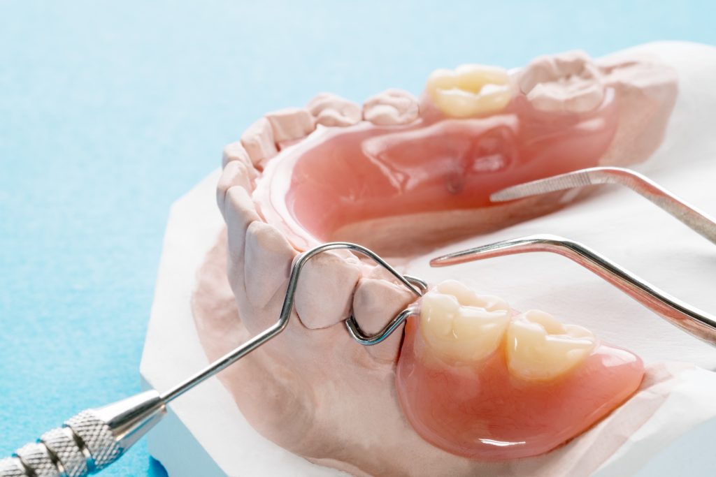 partial dentures, Kiefer Family Dental