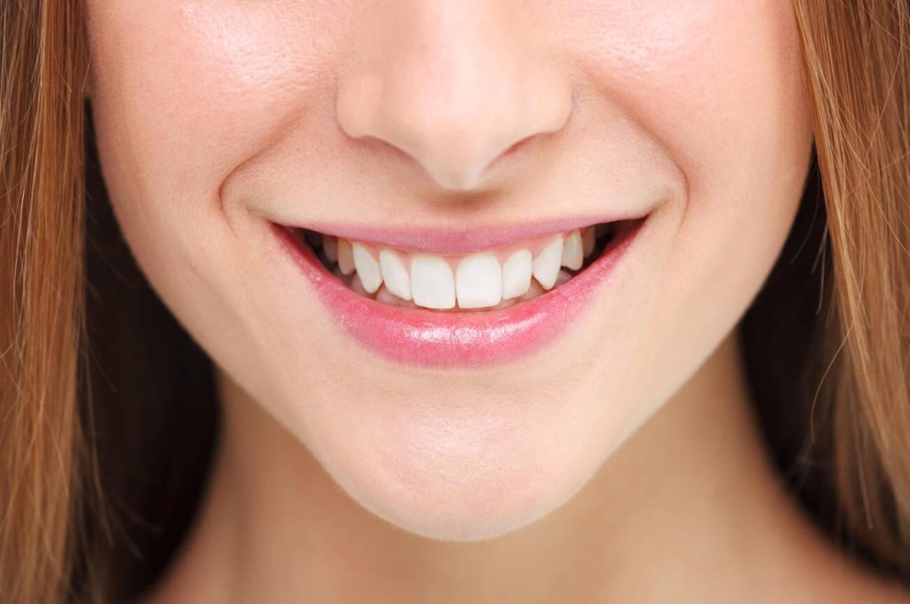 How Often Should I Get Teeth Whitening?