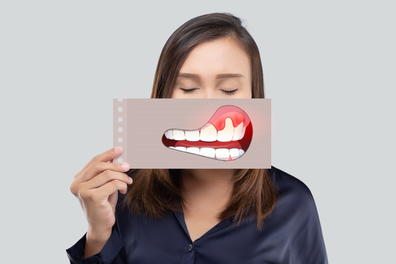 5 Warning Signs of Gum Disease You Shouldn't Ignore | Kiefer Family Dental