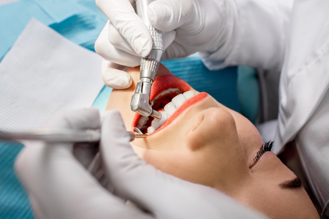 How Professional Cleanings Help Prevent Gum Problems | Kiefer Dental