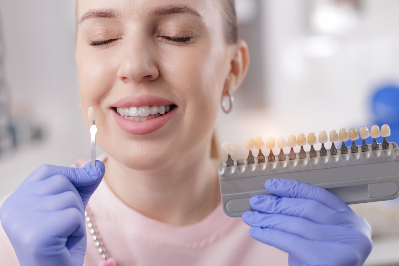 Veneers Expert in Bedford | Kiefer Family Dental
