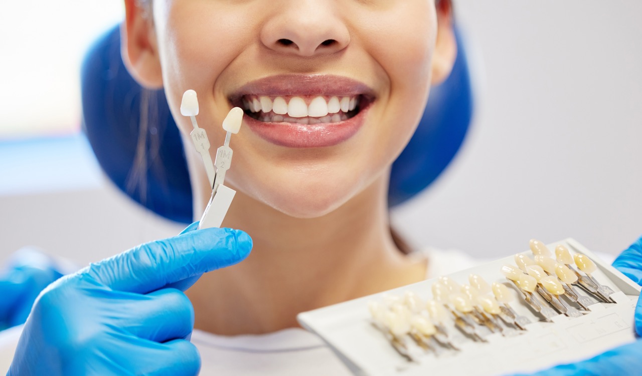 Dental Veneers in Melody Hill | Kiefer Family Dental