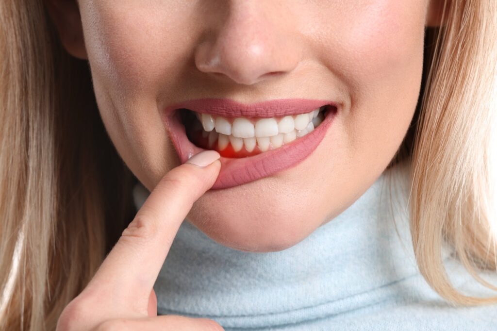 How Long Can You Keep Your Teeth With Periodontal Disease?