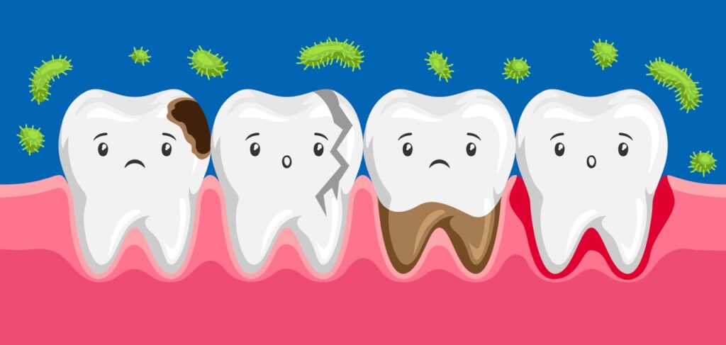 How to Tell If You Have Early Tooth Decay at Home