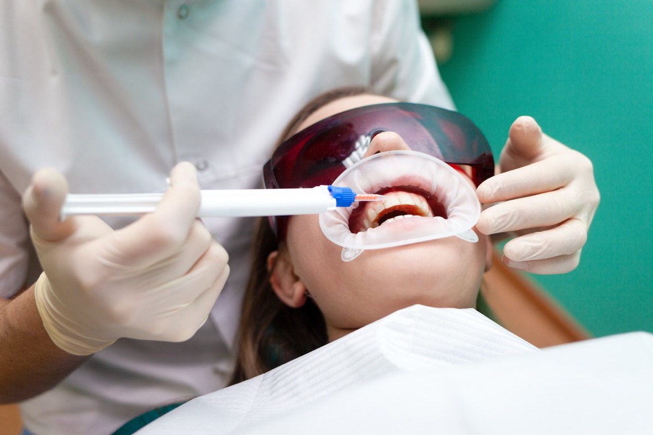 Modern Boonville Teeth Whitening Services Near IN