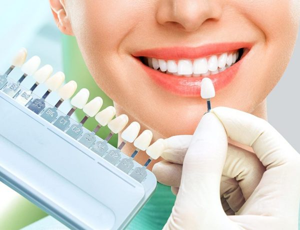 close-up-portrait-young-women-dentist-chair-check-select-color-teeth-dentist-make2
